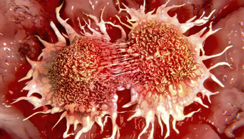 Image result for कैंसर कोशिकाएं