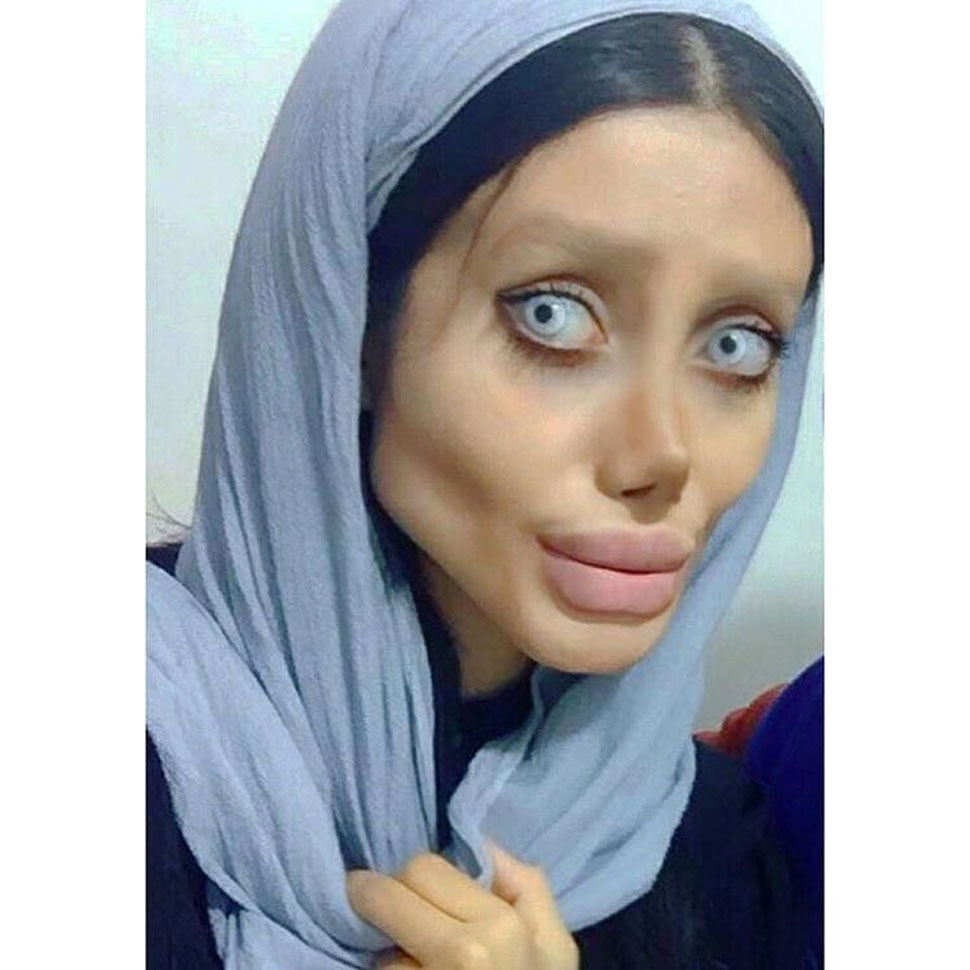 woman went under 50 surgery to look like Angelina jolie see pics