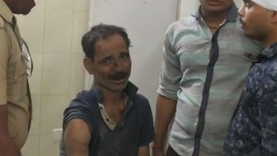 Unnao gangrape how victim father was beaten brutally see pictures