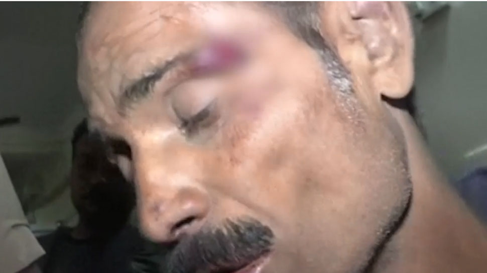 Unnao gangrape how victim father was beaten brutally see pictures