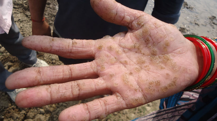 arsenic water