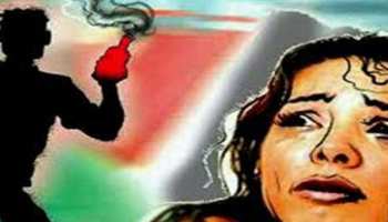 इंदौरः एसिड अटैक सर्वायवर का अब प्रदेश सरकार कराएगी इलाज इंदौरः एसिड अटैक सर्वायवर का अब प्रदेश सरकार कराएगी इलाज