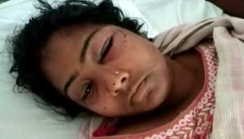 झारखंड : सेल्समैन ने गला दबाकर की महिला की जान लेने की कोशिश, पुलिस ने किया गिरफ्तार झारखंड : सेल्समैन ने गला दबाकर की महिला की जान लेने की कोशिश, पुलिस ने किया गिरफ्तार