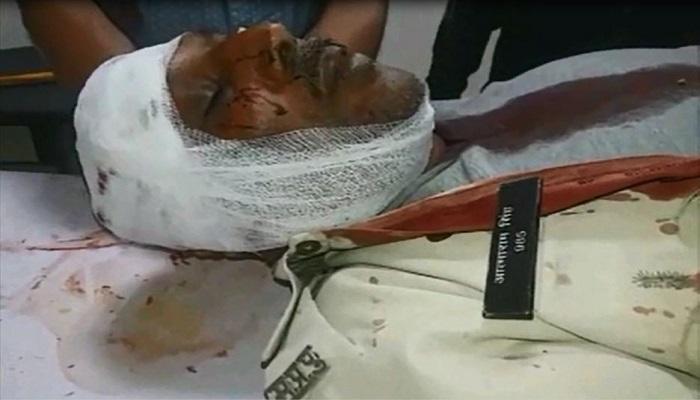 बोरिंग रोकने गए थे, हुआ ये हाल बोरिंग रोकने गए थे, हुआ ये हाल