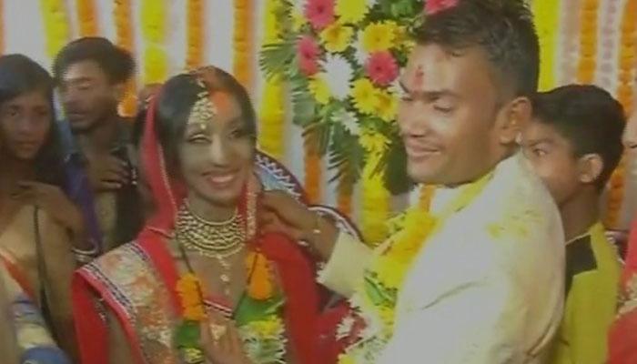 एसिड अटैक पीड़िता को 'रॉन्ग नंबर' से मिला सपनों का राजकुमार एसिड अटैक पीड़िता को 'रॉन्ग नंबर' से मिला सपनों का राजकुमार