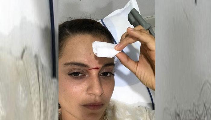 फिल्म की शूटिंग के दौरान तलवारबाजी में घायल हुईं कंगना रनौत, लगे 15 टांके फिल्म की शूटिंग के दौरान तलवारबाजी में घायल हुईं कंगना रनौत, लगे 15 टांके