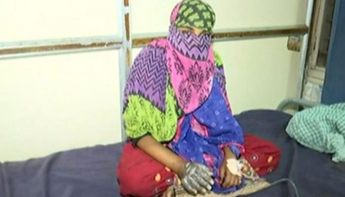 राजकोट: महिला ने की छेड़खानी की शिकायत तो आरोपी की पत्नी ने खौलते तेल में डलवाया हाथ राजकोट: महिला ने की छेड़खानी की शिकायत तो आरोपी की पत्नी ने खौलते तेल में डलवाया हाथ