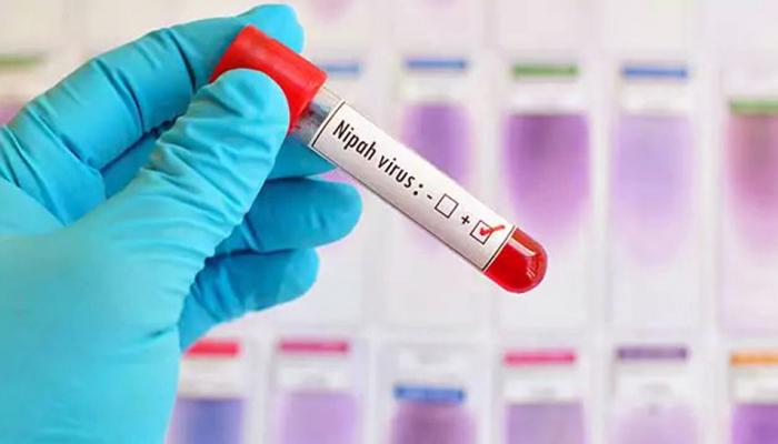 सेना पर निपाह वायरस का 'हमला', एक जवान की मौत, 'रेड अलर्ट' पर बाकी सैनिक सेना पर निपाह वायरस का 'हमला', एक जवान की मौत, 'रेड अलर्ट' पर बाकी सैनिक