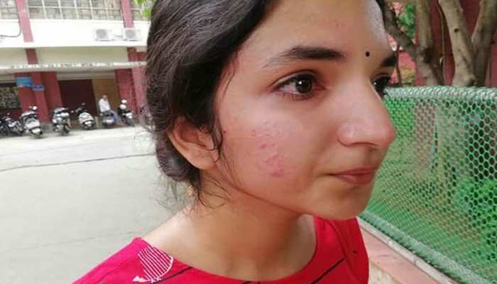 डीयू में आइसा अध्यक्ष ने एबीवीपी के कार्यकर्ताओं पर मारपीट का लगाया आरोप डीयू में आइसा अध्यक्ष ने एबीवीपी के कार्यकर्ताओं पर मारपीट का लगाया आरोप
