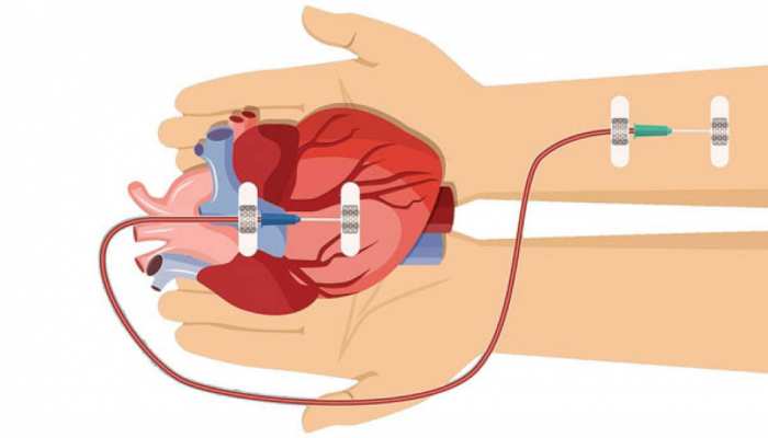 India Today: 82 years old man becomes oldest organ donor in mumbai India Today: 82 years old man becomes oldest organ donor in mumbai