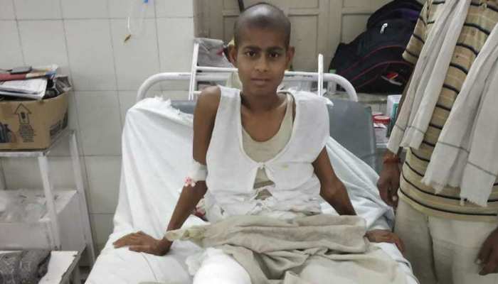राजस्थान में लिक्विड नाइट्रोजन से हड्डी के कैंसर का सफल इलाज राजस्थान में लिक्विड नाइट्रोजन से हड्डी के कैंसर का सफल इलाज