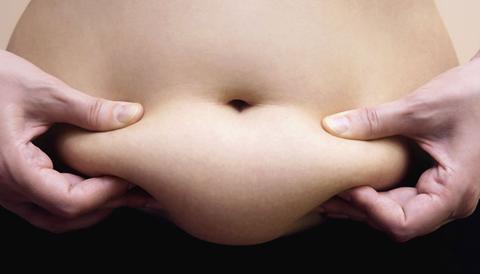 Image result for मोटापे